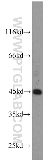 [21922-1-AP-150UL] ZNF763 Polyclonal antibody