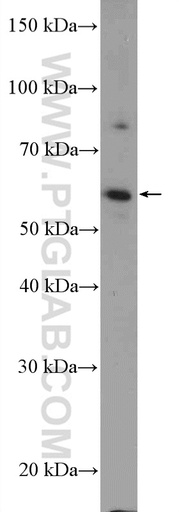 [21930-1-AP-150UL] KIAA0895 Polyclonal antibody