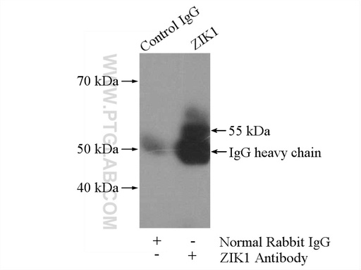 [21934-1-AP-150UL] ZIK1 Polyclonal antibody