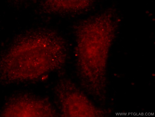 [21935-1-AP-20UL] POLD3 Polyclonal antibody