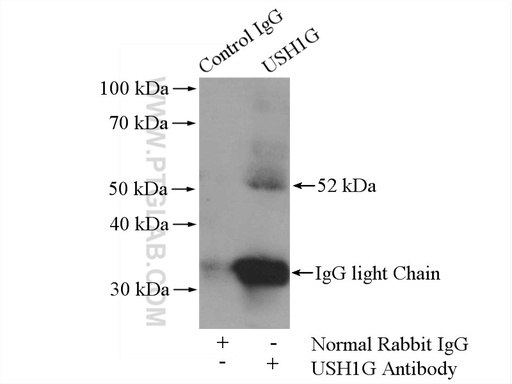 [21936-1-AP-150UL] USH1G Polyclonal antibody