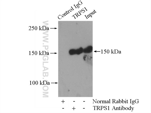 [21938-1-AP-150UL] TRPS1 Polyclonal antibody