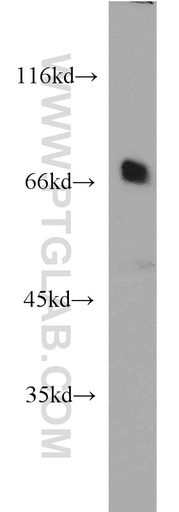 [21946-1-AP-20UL] SNX18 Polyclonal antibody