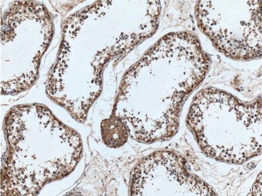 [21951-1-AP-20UL] UCN Polyclonal antibody