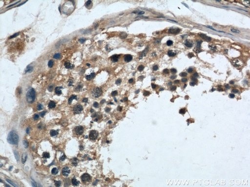 [21958-1-AP-20UL] LOC286135 Polyclonal antibody