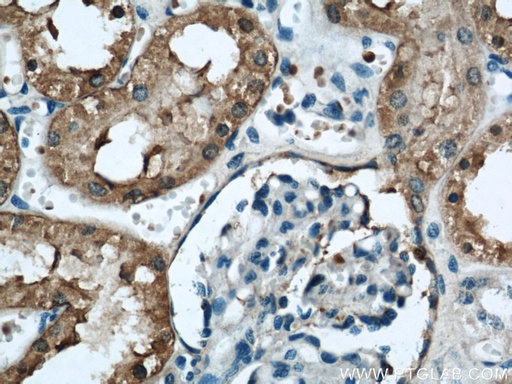 [21959-1-AP-150UL] FTCD Polyclonal antibody