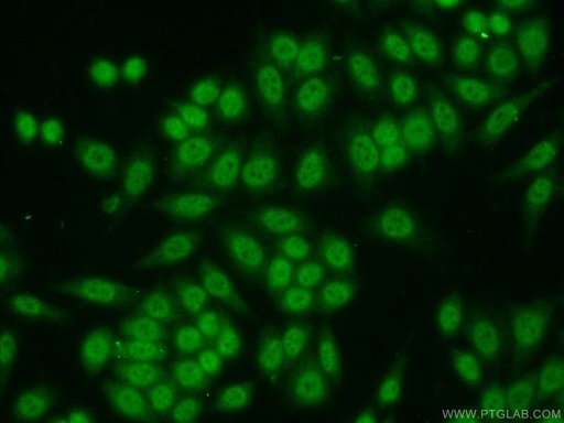 [21962-1-AP-150UL] SP1 Polyclonal antibody