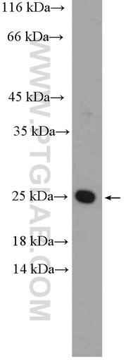 [21966-1-AP-20UL] LMO2 Polyclonal antibody