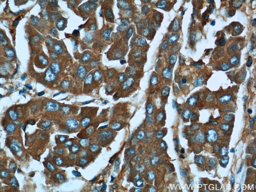 [21970-1-AP-20UL] MACC1 Polyclonal antibody