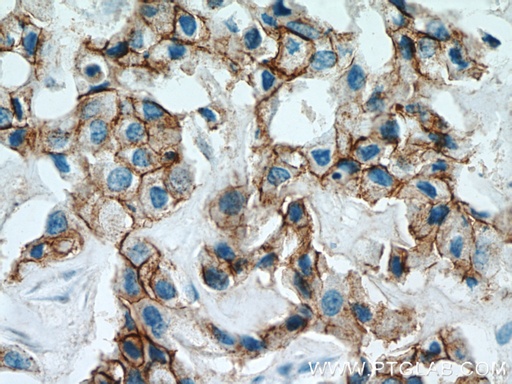 [21972-1-AP-150UL] ALCAM Polyclonal antibody