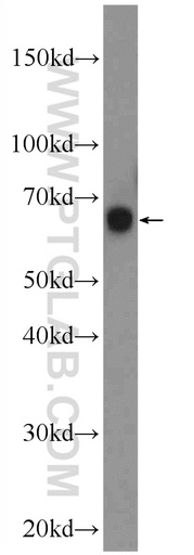 [21981-1-AP-150UL] KLHL34 Polyclonal antibody