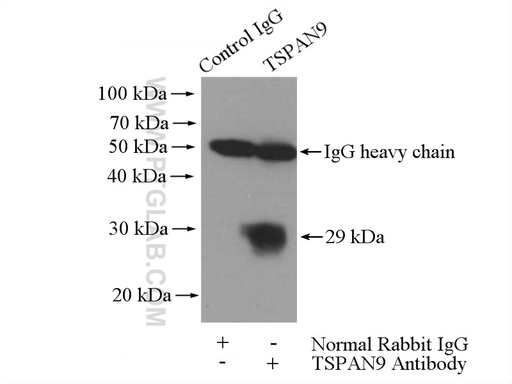 [21983-1-AP-20UL] TSPAN9 Polyclonal antibody