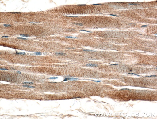 [21987-1-AP-150UL] TSPAN31 Polyclonal antibody