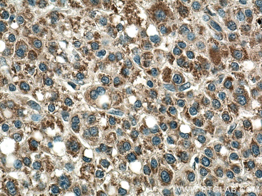 [21988-1-AP-20UL] PCCA Polyclonal antibody