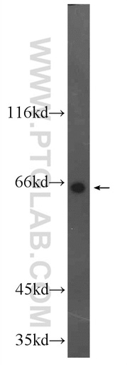 [21989-1-AP-20UL] DDX56 Polyclonal antibody