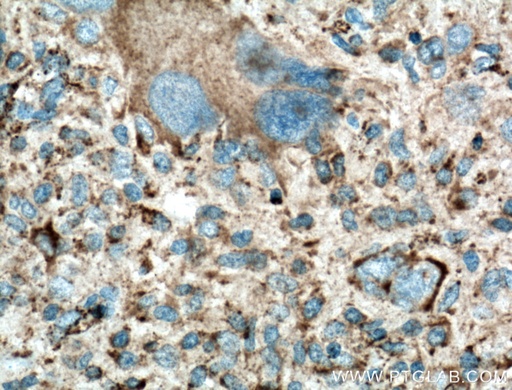 [21997-1-AP-150UL] LAMP1 Polyclonal antibody
