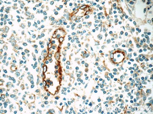 [22003-1-AP-20UL] CLEC4M Polyclonal antibody