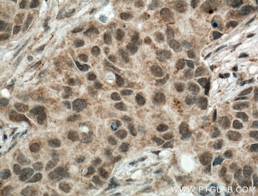 [22006-1-AP-150UL] TBP Polyclonal antibody