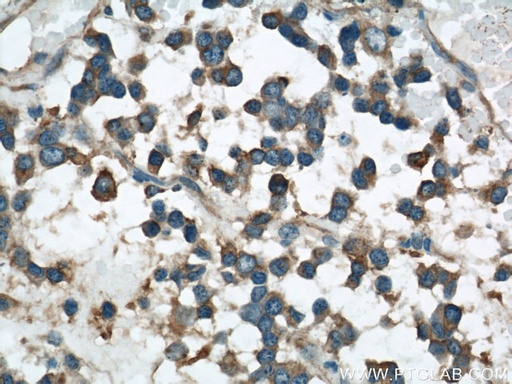[22016-1-AP-20UL] VAT1 Polyclonal antibody