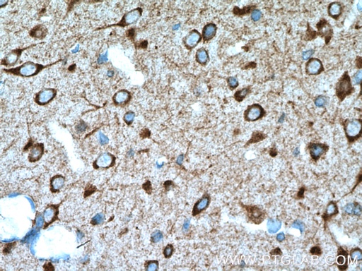 [22022-1-AP-150UL] DRD2 Polyclonal antibody