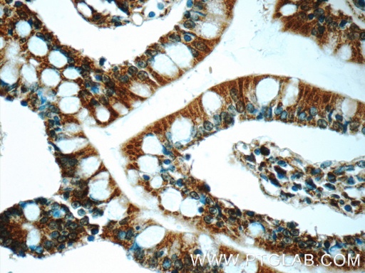 [22030-1-AP-150UL] iPLA2 Polyclonal antibody