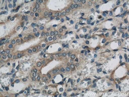 [22033-1-AP-20UL] SARA Polyclonal antibody