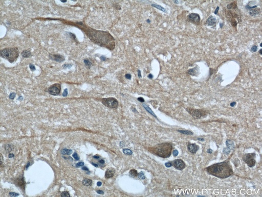 [22042-1-AP-150UL] CALHM1 Polyclonal antibody