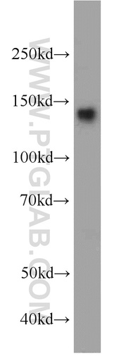 [22045-1-AP-20UL] AHI1 Polyclonal antibody