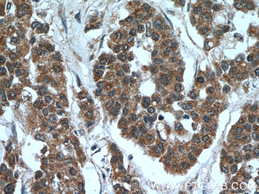 [22046-1-AP-150UL] C5orf4 Polyclonal antibody