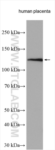 [22049-1-AP-150UL] Cadherin-20 Polyclonal antibody