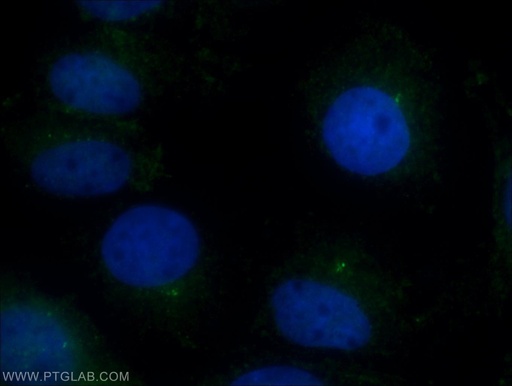 [22050-1-AP-20UL] CEP97 Polyclonal antibody