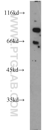 [22051-1-AP-150UL] FOXP1 Polyclonal antibody
