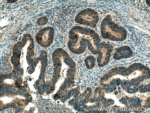 [22058-1-AP-20UL] B9D2 Polyclonal antibody