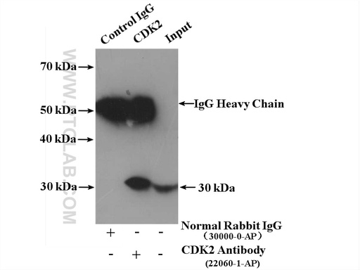[22060-1-AP-150UL] CDK2 Polyclonal antibody