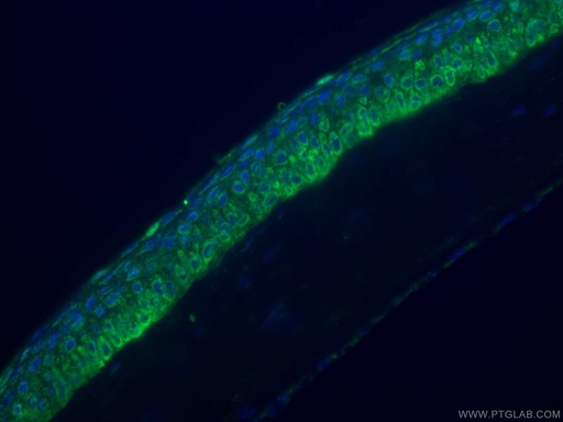 [22063-1-AP-150UL] PDE6B Polyclonal antibody