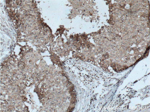 [22065-1-AP-20UL] LTBP1 Polyclonal antibody