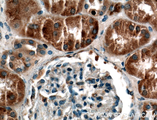 [22076-1-AP-20UL] SYTL3 Polyclonal antibody