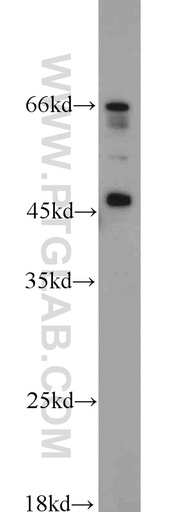 [22078-1-AP-20UL] PRDM7 Polyclonal antibody