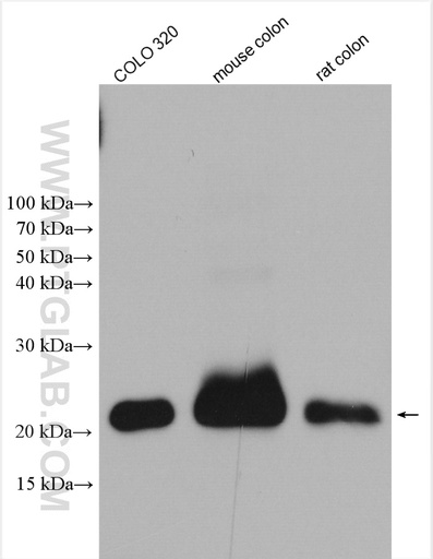 [22080-1-AP-20UL] PPP1R14D Polyclonal antibody