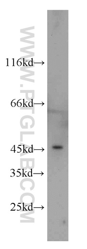 [22081-1-AP-20UL] FOXD4L6 Polyclonal antibody
