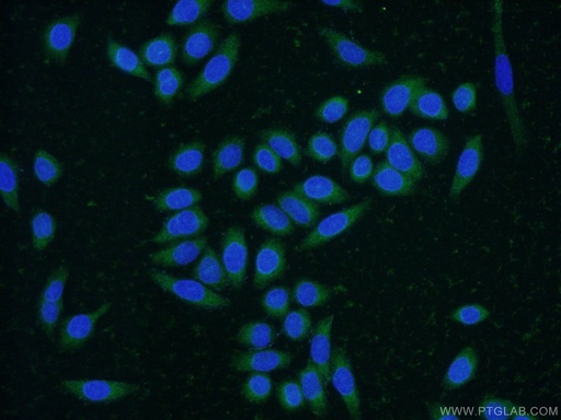 [22086-1-AP-20UL] CNPY4 Polyclonal antibody