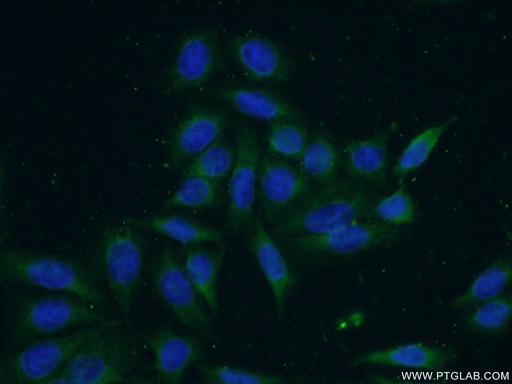 [22088-1-AP-20UL] DULLARD Polyclonal antibody