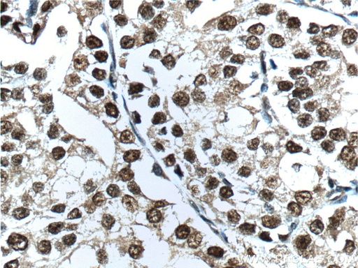 [22089-1-AP-20UL] androgen receptor Polyclonal antibody