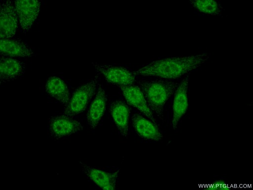 [22094-1-AP-150UL] TLE3 Polyclonal antibody