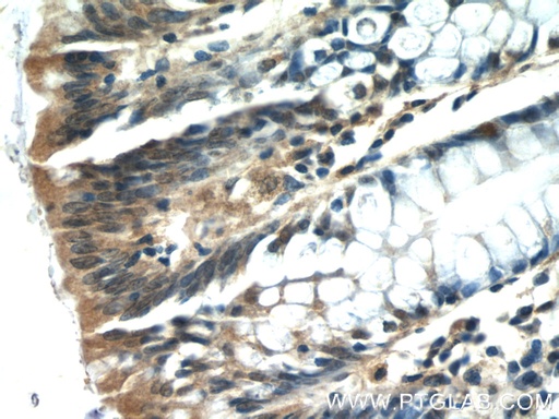 [22097-1-AP-150UL] ISG20 Polyclonal antibody