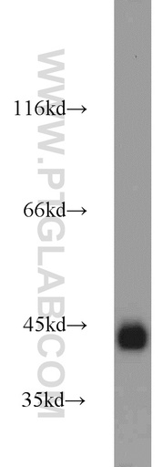 [22099-1-AP-150UL] Podoplanin Polyclonal antibody