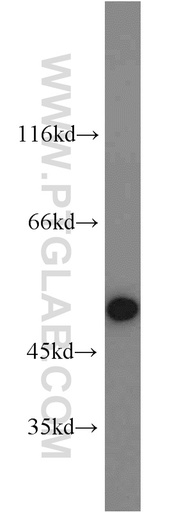 [22103-1-AP-20UL] RBM22 Polyclonal antibody