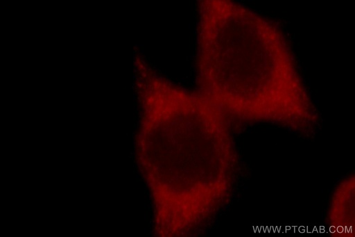 [22104-1-AP-150UL] GSK3B Polyclonal antibody
