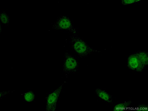 [22114-1-AP-20UL] AP1,JUN,P39 Polyclonal antibody