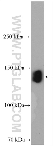 [22116-1-AP-150UL] ZO-3 Polyclonal antibody